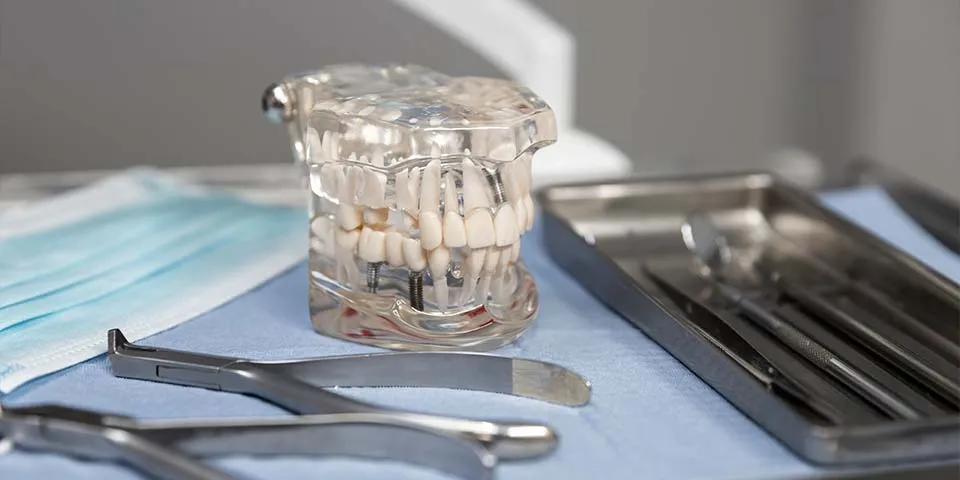 Secure your confidence with a full overdenture connected to dental implants.