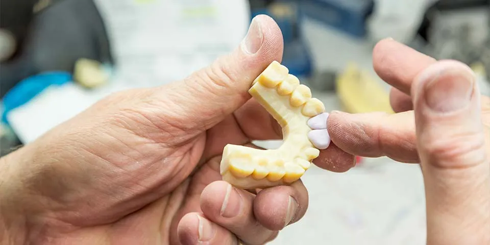 Easy-to-care for dental implants can also be used to replace several missing teeth with just one implant.