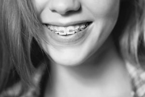 Close up portrait of smiling teen girl showing dental braces. Isolated on white background.