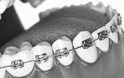 Patient Testimonial: Orthodontic Treatment
