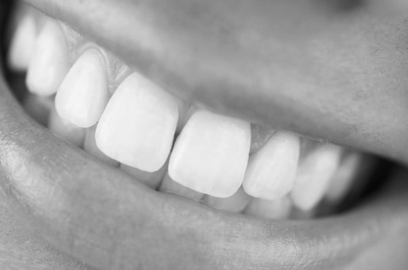 Deep Bite Treatment: A Short but Complete Guide to a Better Smile